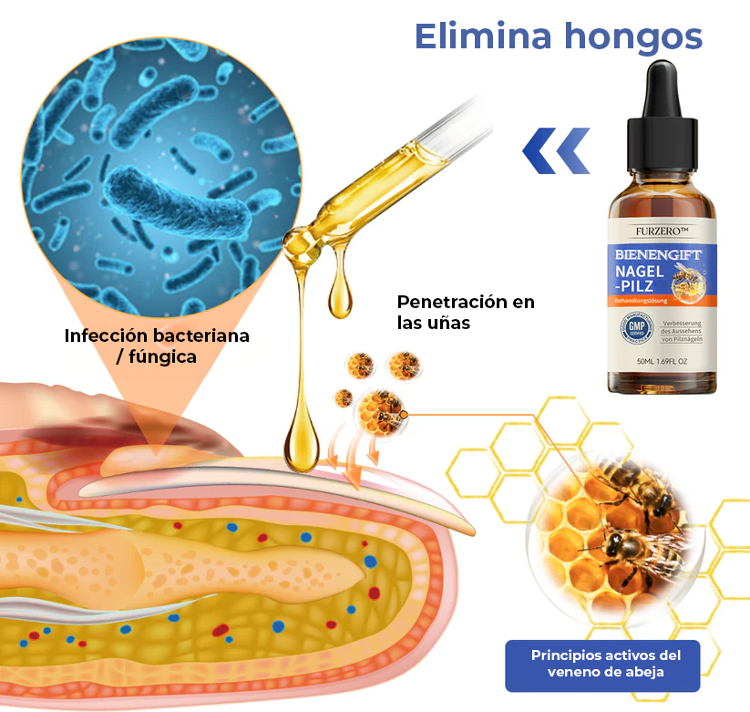 [2X1] MyCare® |ELIMINA LOS HONGOS DE LAS UÑAS EN 5 DÍAS Y EVITA QUE APEREZCAN PARA SIEMPRE