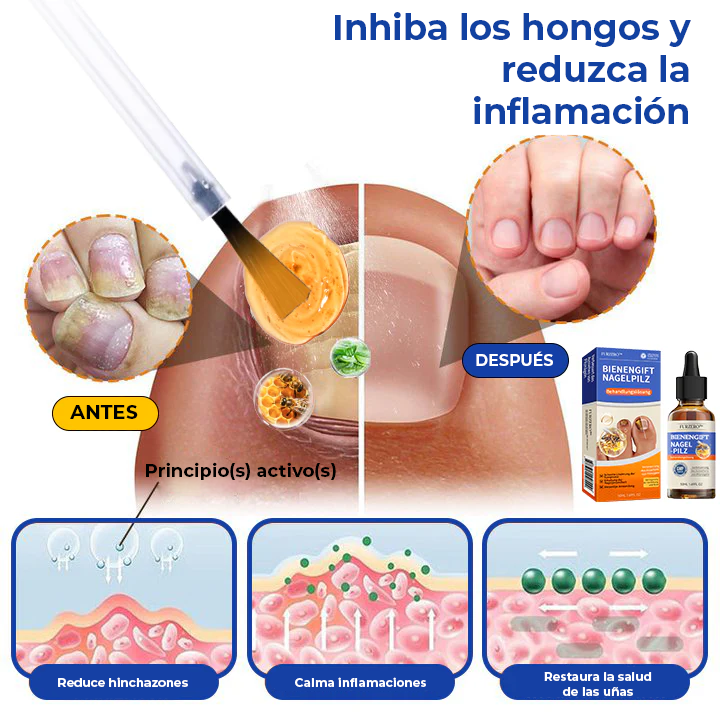 [2X1] MyCare® |ELIMINA LOS HONGOS DE LAS UÑAS EN 5 DÍAS Y EVITA QUE APEREZCAN PARA SIEMPRE